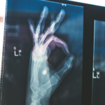 X ray of hand giving the OK sign